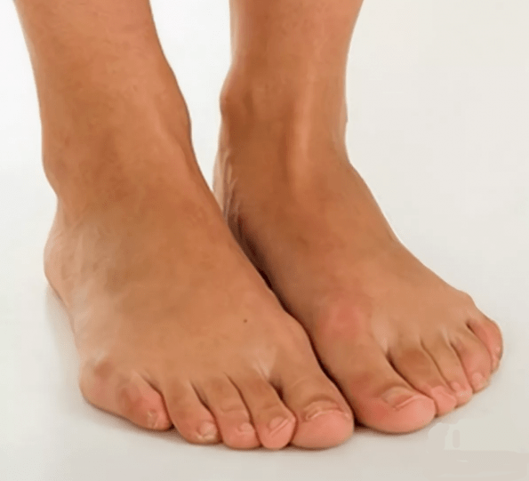 Healthy feet after Hondrox spray treatment