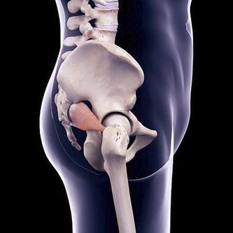 Dagger back pain can be a result of a piriformis muscle spasm