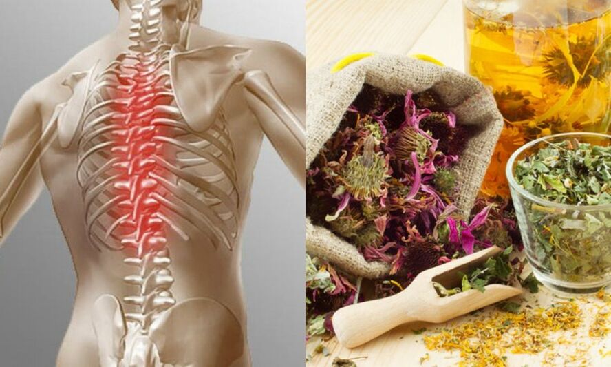 Traditional recipes - preventing the development of osteochondrosis and supporting the health of the spine