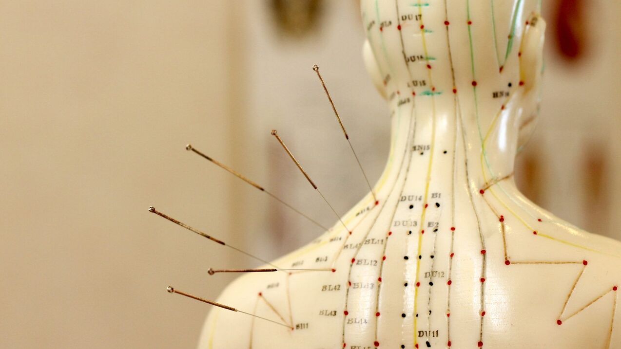 acupuncture in cervical osteochondrosis