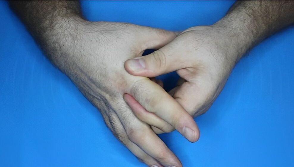 exercises for fingers with arthritis