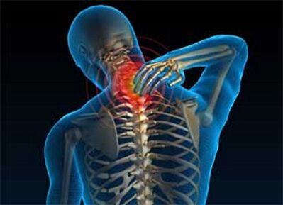 The neck pain is a common symptom of osteochondrose