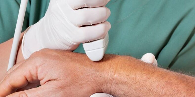 arthritis as the causes of pain in the joints of the fingers