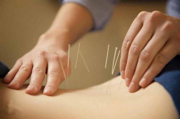 treatment of osteochondrosis with acupuncture